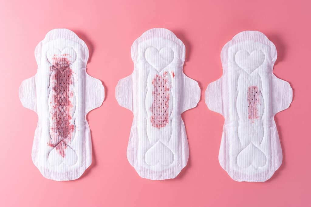 implantation bleeding on a sanitary pad