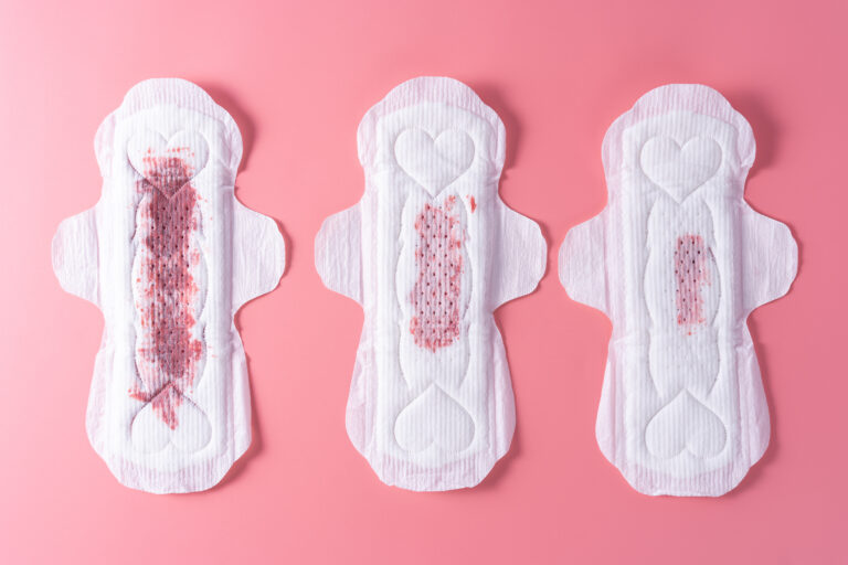 implantation bleeding on a sanitary pad