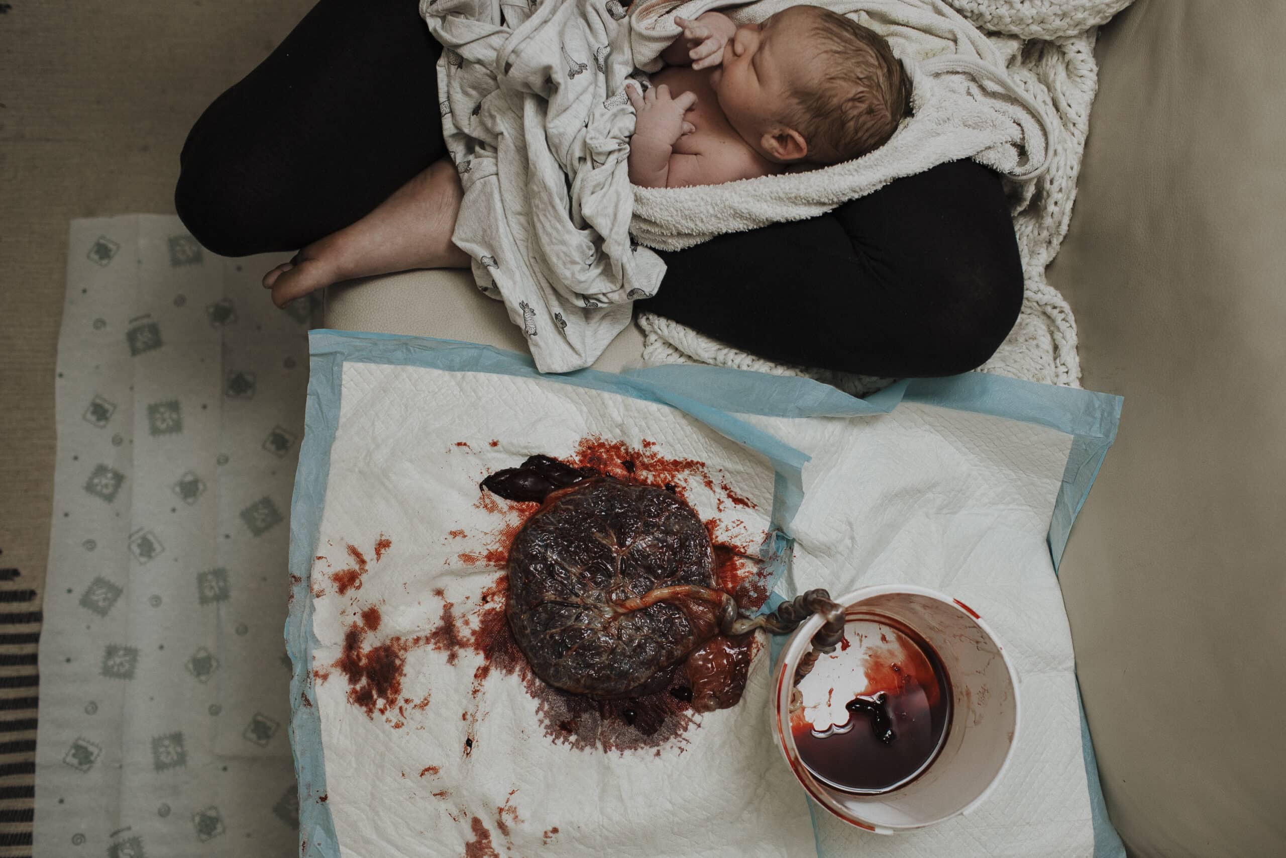 placenta birth