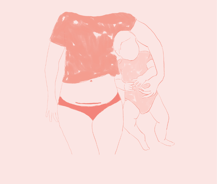 The Caesarean Birth Class